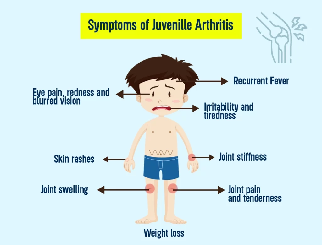Addressing Juvenile Arthritis in Children