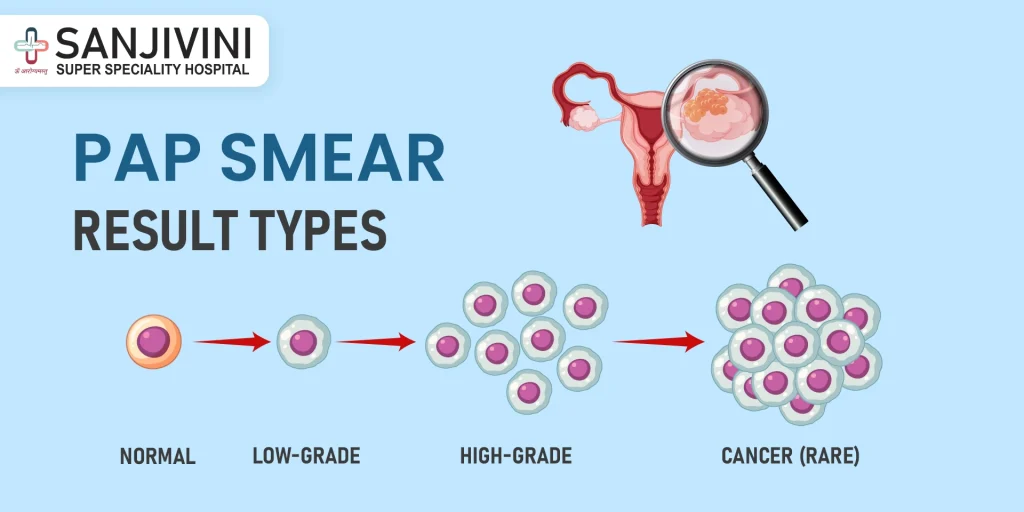 Pap smear test results categories chart for cervical health awareness